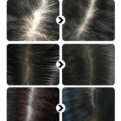 Sevich Hair growth ginger shampoo 100ml Anti Hair Loss. Sevich Hair Growth Ginger shampoo 100ml anti hair loss