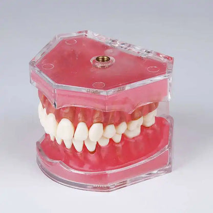 Dental Standard Typodont  Model Soft Gum  With 28 Removable Teeth Adult for Study Demo Teaching