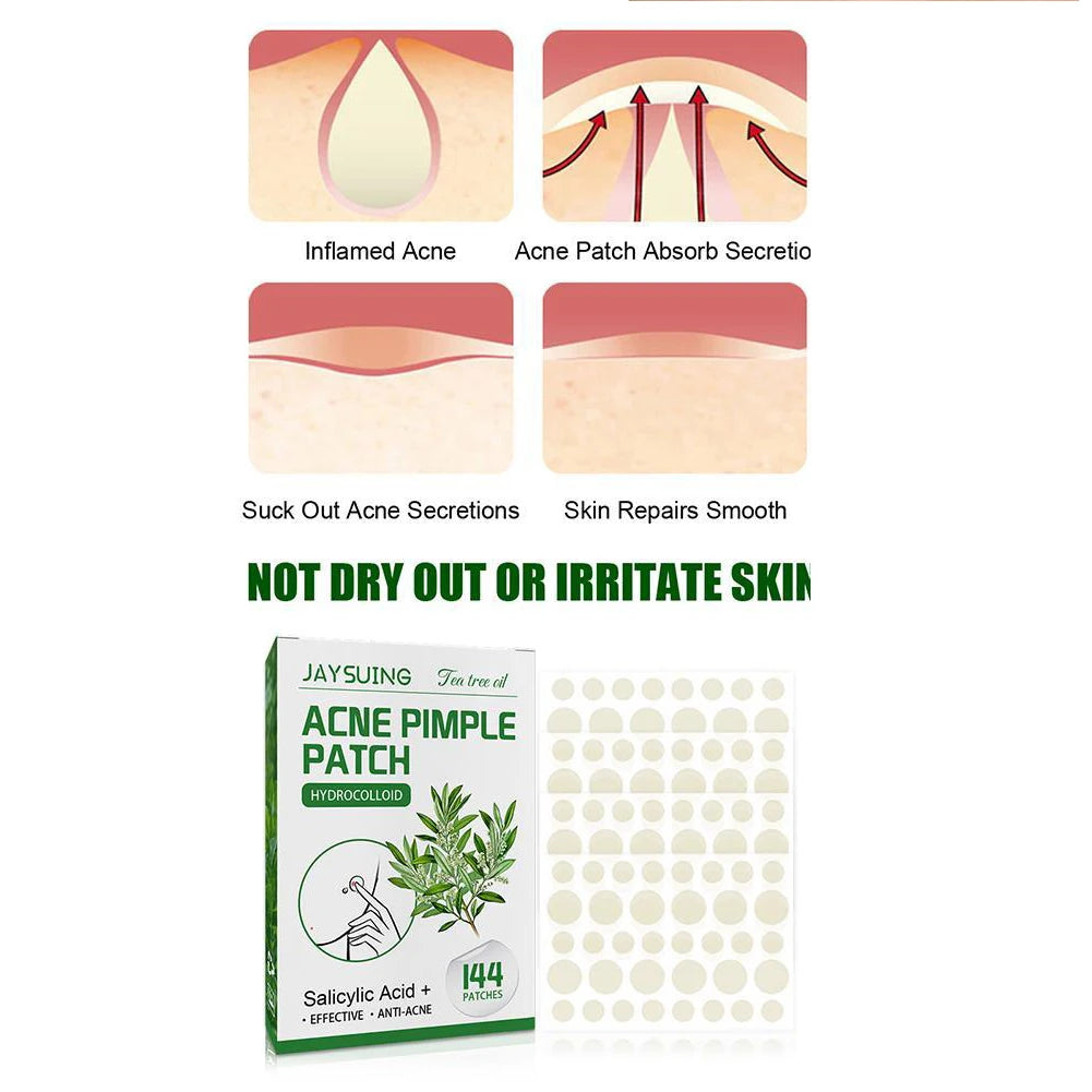 144pcs Acne Pimple Patches Translucent Matte Hydrocolloid Salicylic Acid Tea Tree Oil For Inflamed Acne Improve Whiteheads