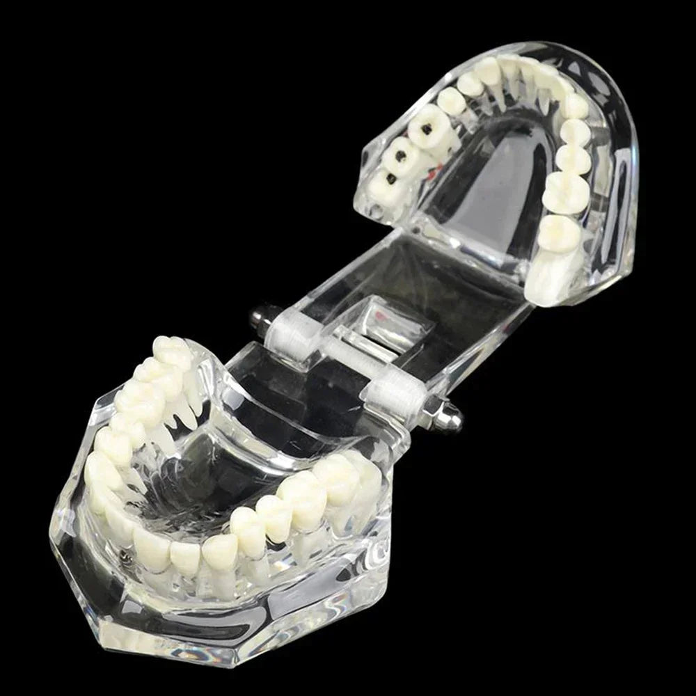 Dental Models Removable And Restorable Models Of Diseased Teeth For Teaching And Researching Medical And Dental Diseases