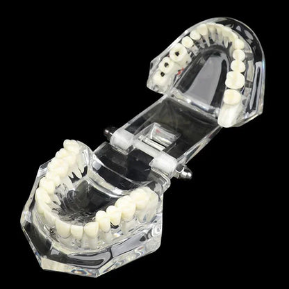 Dental Models Removable And Restorable Models Of Diseased Teeth For Teaching And Researching Medical And Dental Diseases