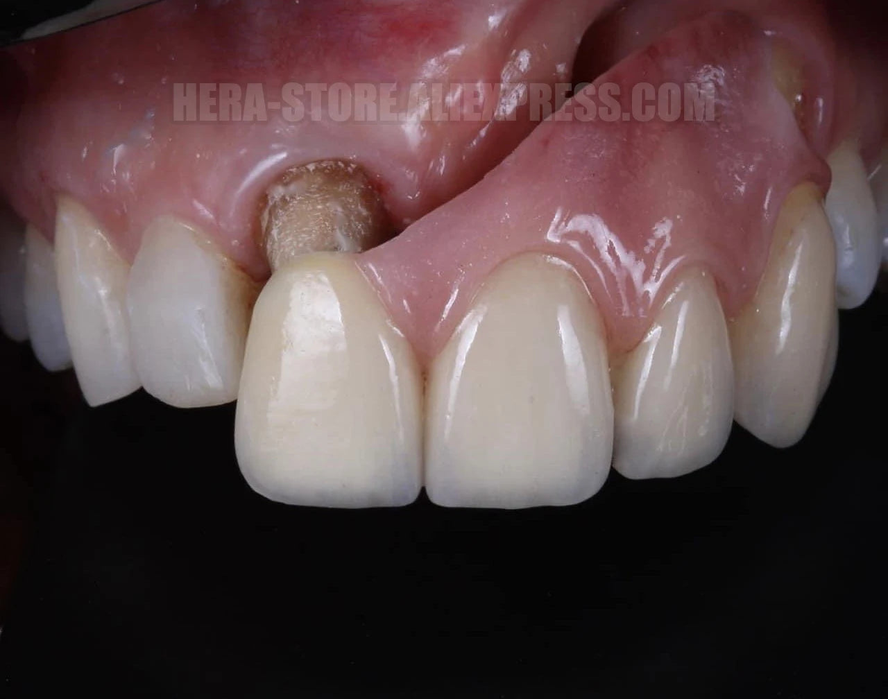 Dental Photo LED Light. Dental Photography Light. Macro, Polarizer, Intraoral, Denture Photo With Phone Lamp For Dentistry