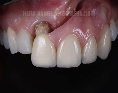 Dental Photo LED Light. Dental Photography Light. Macro, Polarizer, Intraoral, Denture Photo With Phone Lamp For Dentistry