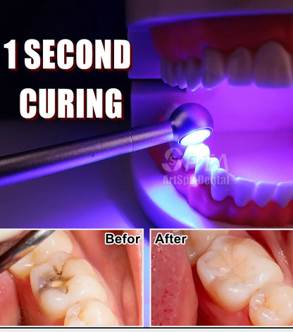 1 Second Dentistry Equipment Orthodontist Orthodontic Composite Curing Light LED Cure Lamp Dental Composite High Intensity
