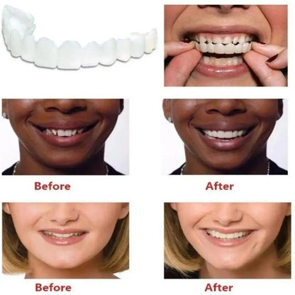 Snap On Teeth Veneers Cover The Imperfects Teeth Fake Tooth Instant Confidence Smile Temporary Teeth Teeth Beauty Tool Cosmetic