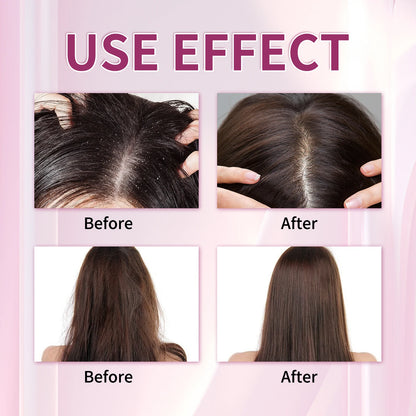 200ML Onion&Rosemary Shampoo For Hair Growth Anti Frizz Dandruff Removal Improve Dry Split Ends Nourishing Smooth Conditioner