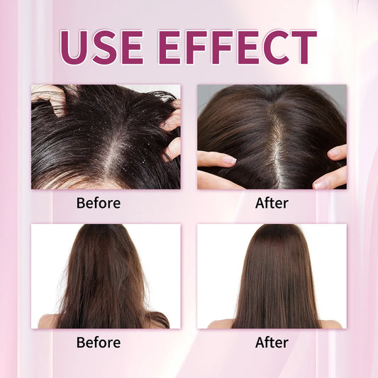 200ML Onion&Rosemary Shampoo For Hair Growth Anti Frizz Dandruff Removal Improve Dry Split Ends Nourishing Smooth Conditioner