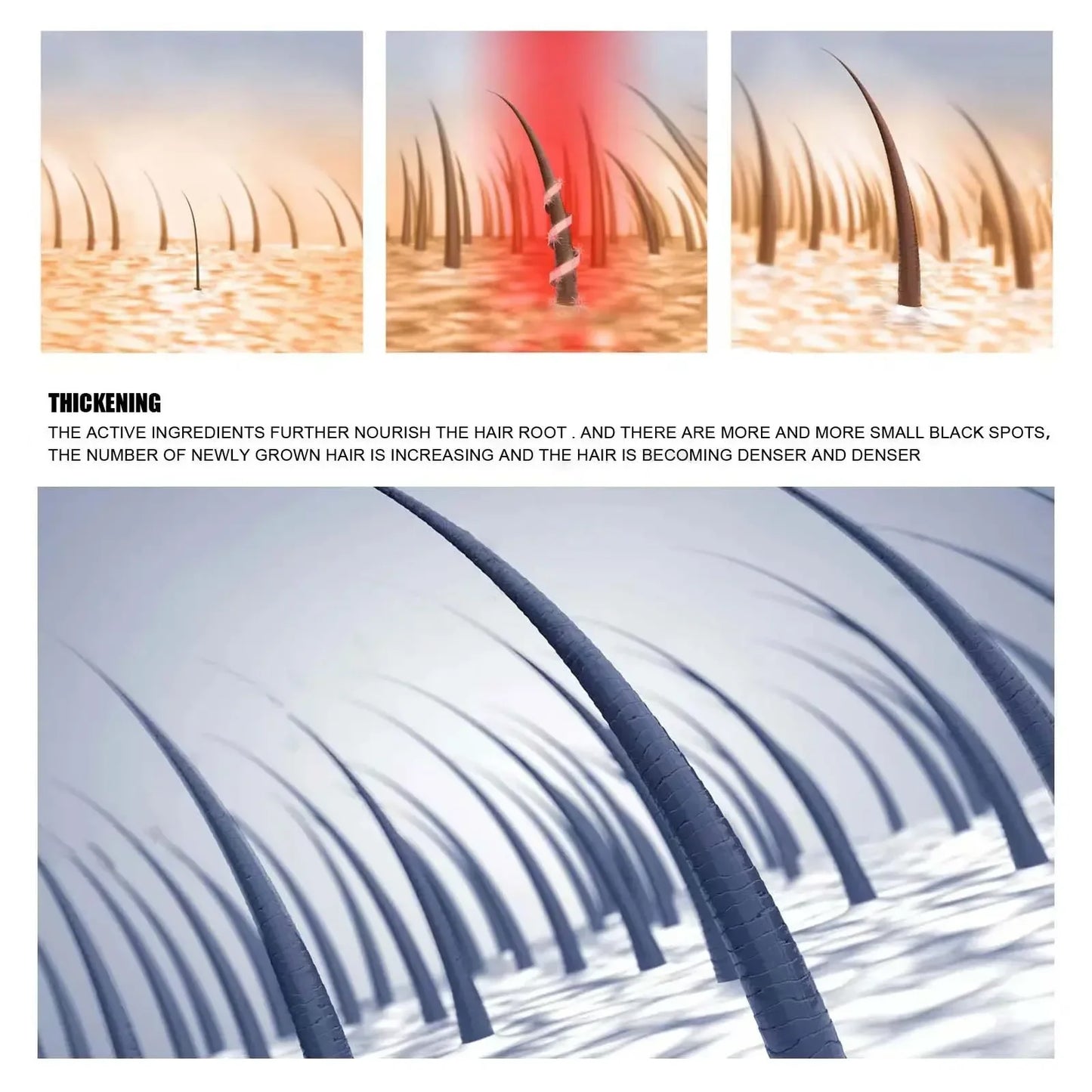 Hair Growth Oil Fast Growing Hair Effective Essential Baldness Repair Hereditary Anti Postpartum Seborrheic Hair Loss Products