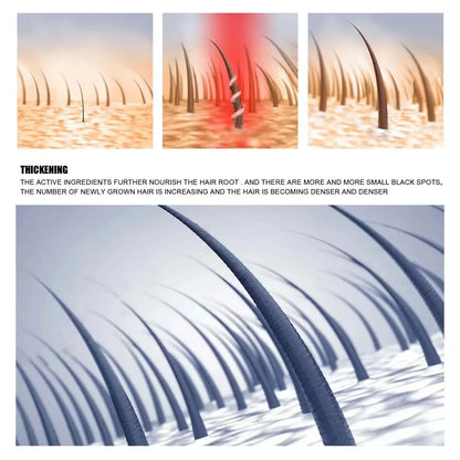 Hair Growth Oil Fast Growing Hair Effective Essential Baldness Repair Hereditary Anti Postpartum Seborrheic Hair Loss Products