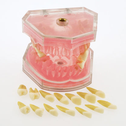 Dental Standard Typodont  Model Soft Gum  With 28 Removable Teeth Adult for Study Demo Teaching