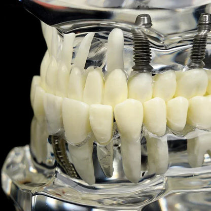 Dental Models Removable And Restorable Models Of Diseased Teeth For Teaching And Researching Medical And Dental Diseases