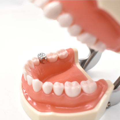 10pcs/lot Dental Primary Molar Crown Teeth 1st 2nd Preformed Stainless Steel Temporary Crowns Kit Adult Kids Dentistry