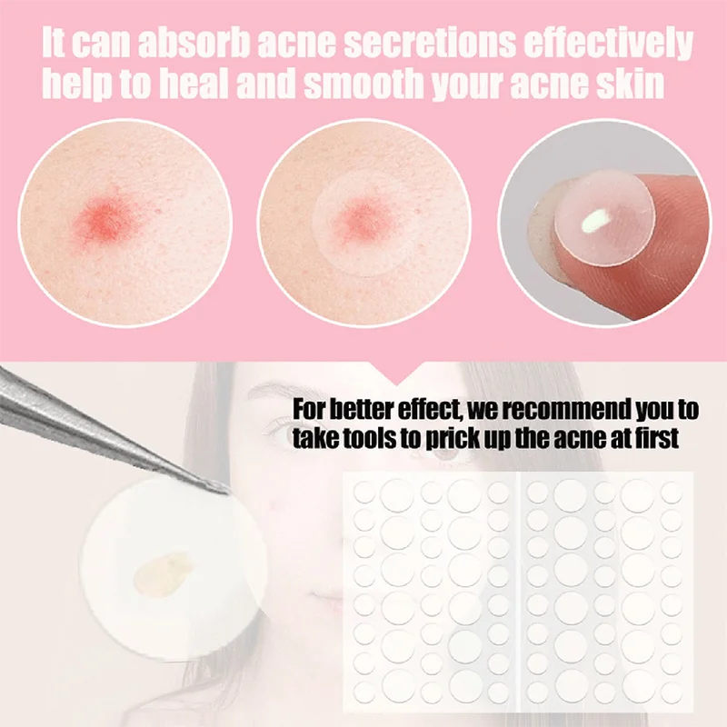 36pcs Face and Body Pimple Patches for Covering Pimples, Acne Patches or Zit Spots Stickers, Body Patches