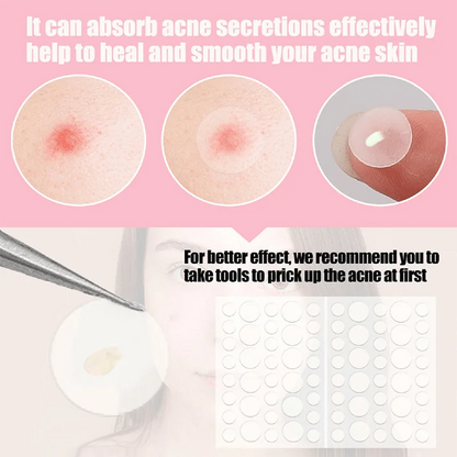 36pcs Face and Body Pimple Patches for Covering Pimples, Acne Patches or Zit Spots Stickers, Body Patches