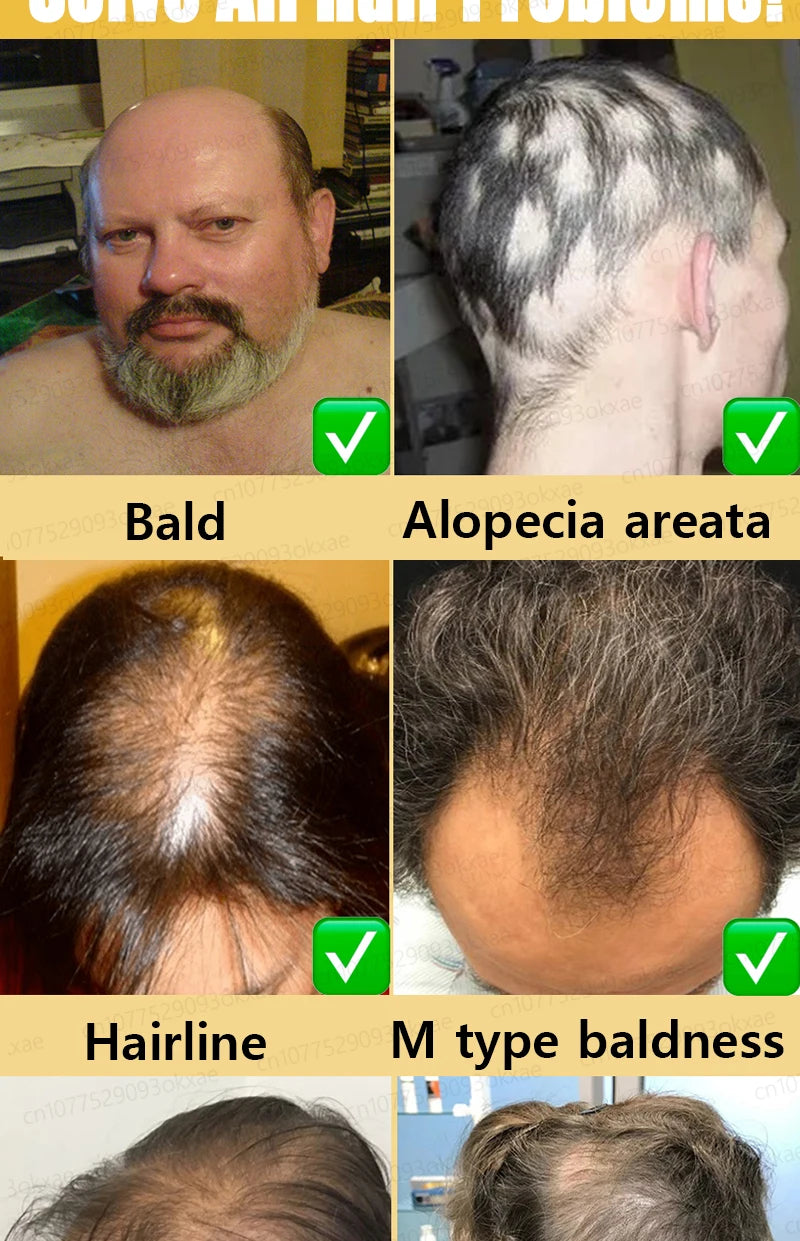 The latest hair serum for 2025. Quickly repair hair follicles and say goodbye to hair loss.
