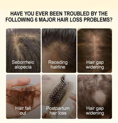 PURC Ginger Hair Serum for Men Women Scalp Treatment Repair Damaged Dry Moisturizing Hair Care Products 50ml