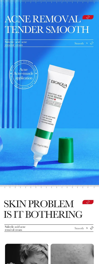 Salicylic Acid Face Cream Acne Creams Mark Repair Firming Moisturizing Blackhead Remover skincare Facial Cream