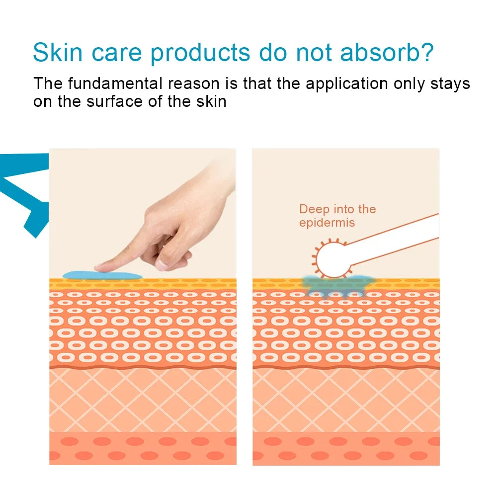 Titanium Derma Pen Roller Hair Growth Beard 540 Microneedle Roller for Facial Skin Care MTS Micro Needle Roller Mesotherapy Use