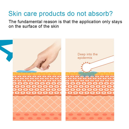 Titanium Derma Pen Roller Hair Growth Beard 540 Microneedle Roller for Facial Skin Care MTS Micro Needle Roller Mesotherapy Use