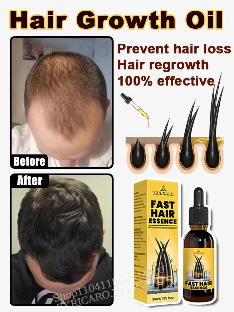 2025 Hair growth oil, repair baldness, hairline, rapid hair growth hair growth oil for men