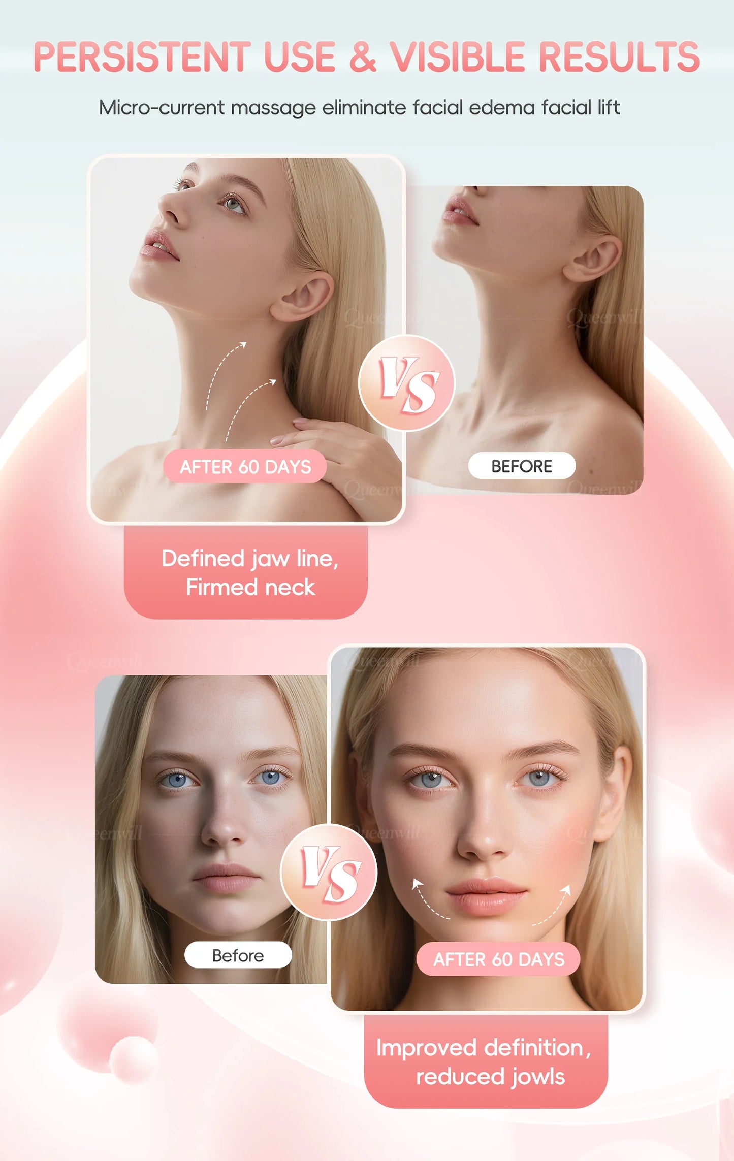 Microcurrent EMS Face Lifting Roller Facial Massager Skin Tightening Rejuvenation Anti-Wrinkle Rechargeable Device Beauty Tool