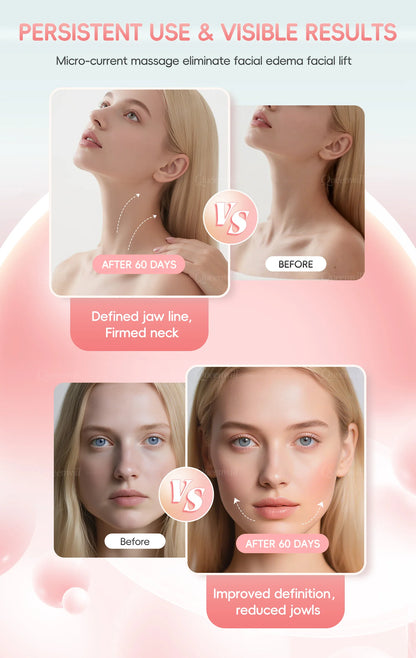 Microcurrent EMS Face Lifting Roller Facial Massager Skin Tightening Rejuvenation Anti-Wrinkle Rechargeable Device Beauty Tool