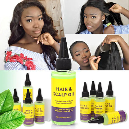 Hair Scalp Oil 65Ml Anti Drynes Soothes Itchy Scalp And Removes Product Build Up Infused With Bacuri Butter Aloe&Peppermint Oil