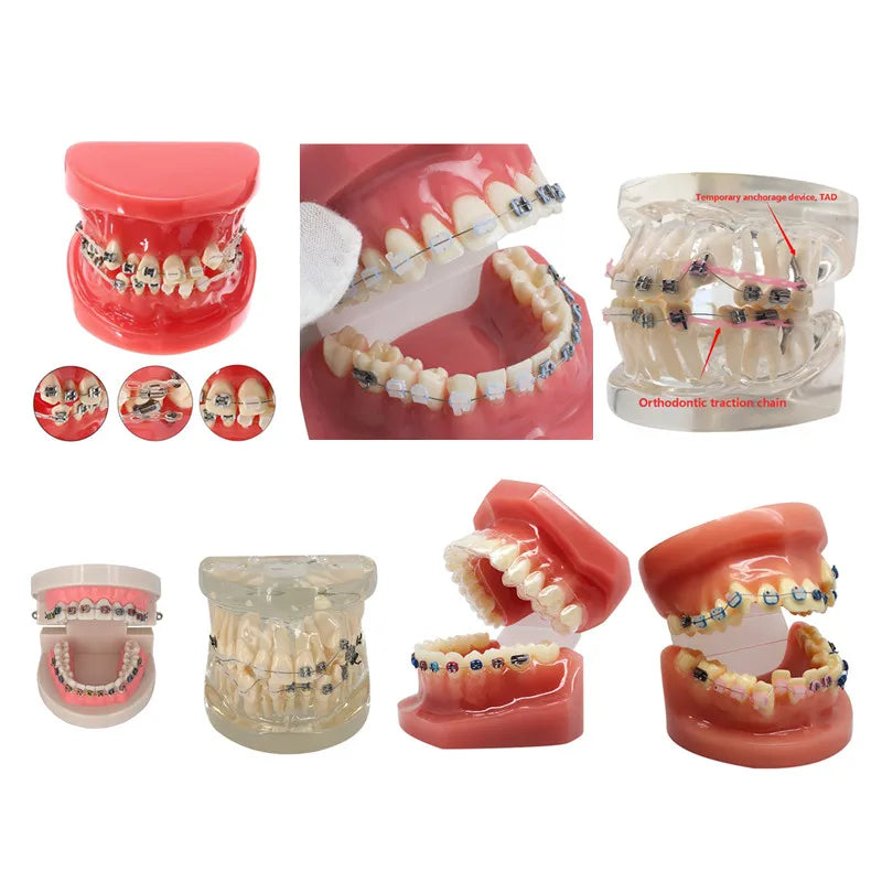 41 Styles Dental Model Teeth Teaching Model Dentist Typodont Orthodontic Jaw Model For Studying   Dentistry Products Accessories