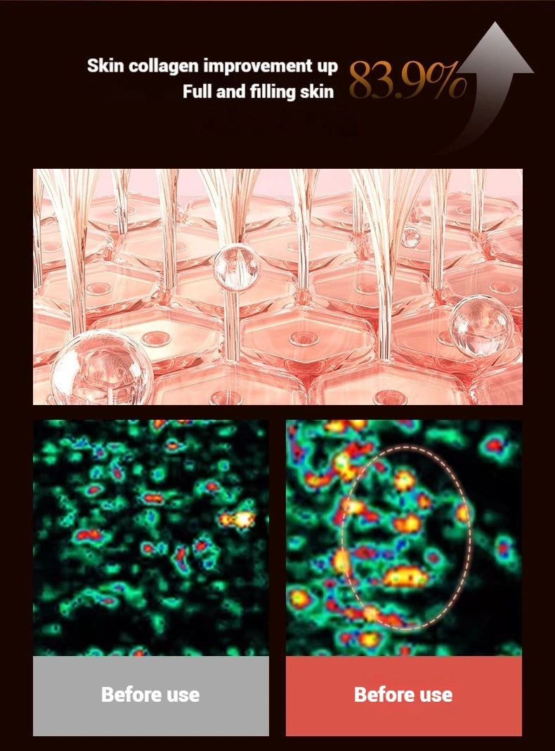 Electric Facial Roller Massager - EMS Microcurrent V-Shape Lifting Device for Face Contouring, Anti-Aging Skin Care & Hydration