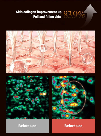 Electric Facial Roller Massager - EMS Microcurrent V-Shape Lifting Device for Face Contouring, Anti-Aging Skin Care & Hydration