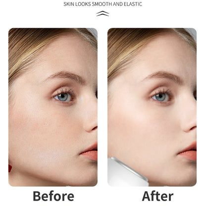 Skin Ice Roller Lifting Anti-wrinkle Face Cooling Massager Calm Skin Ice Cooler Eye Pouch Neck Massager Cooler Edema Remover