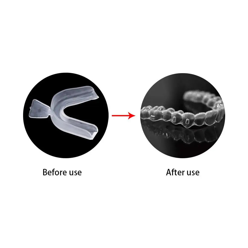 Clenching Mouthguard Bruxism Teeth Guard Stop Teeth Grinding Teeth Whitening Boxing Protection Guard Mouth Tray Mouth Guard