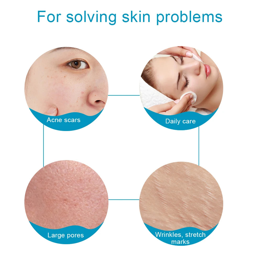 Beauty Derma Roller 540 Microneedle Roller Premium Micro Needling Roller for Men Women Skin Facial Beauty Micro Needle Roller