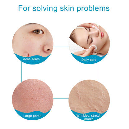 Beauty Derma Roller 540 Microneedle Roller Premium Micro Needling Roller for Men Women Skin Facial Beauty Micro Needle Roller