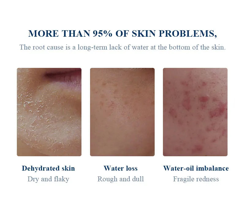 BELYN BERLY Face Serum 3Pcs/Lot Hyaluronic Acid + Vitamin C + 24k Gold Serum Moisturizing Spot White Facial Serum