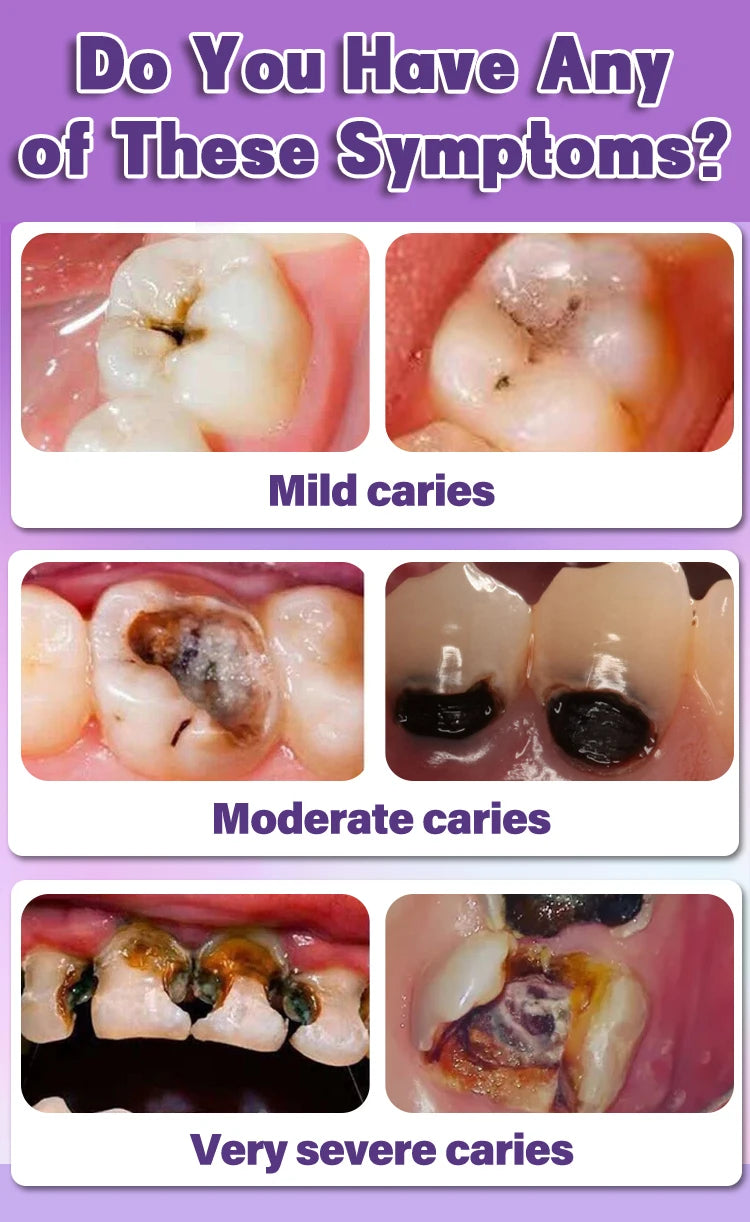 Solve all dental problem tooth decay repair tooth repair fast teeth whitening clean teeth teeth repair cavities