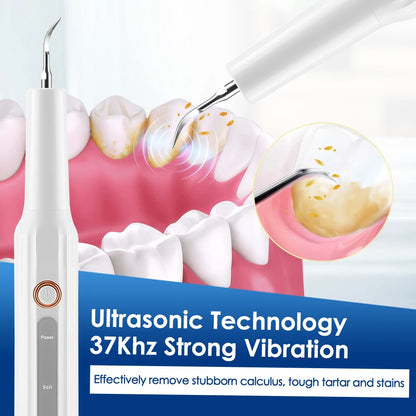 Ultrasonic Dental Calculus Remover With LED Light Teeth Plaque Scaler Tartar Stains Cleaner Electric Dental Whitening Oral Tools