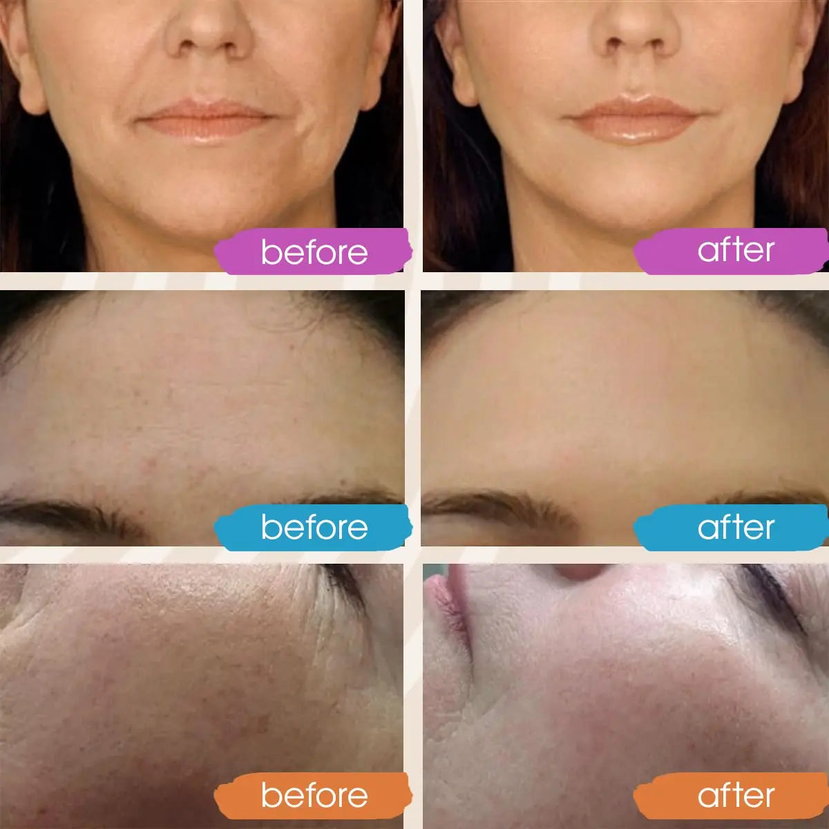 Facial Serums Skin Care Set  Moisturizing Retinol +Hyaluronic Acid + Vitamin C Serum Brightening Firming, & Hydrating Face Serum