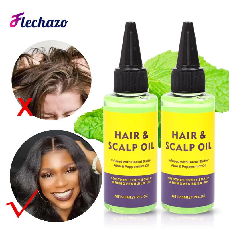Hair Scalp Oil 65Ml Anti Drynes Soothes Itchy Scalp And Removes Product Build Up Infused With Bacuri Butter Aloe&Peppermint Oil