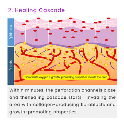 Facial Microneedle Roller Massage DRS 540 Derma Roller Needle Instrument Face Roller Massager Needles Skin Care Tool for Face