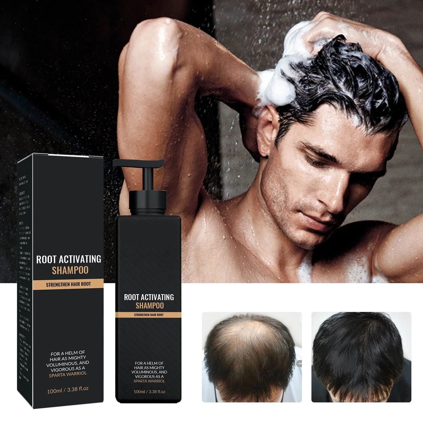Spartan Root Activator Shampoo,Root Activator Shampoo, Hair Loss Shampoo, Hair Thickening ShampooUnisex Root Activator Shampoo,