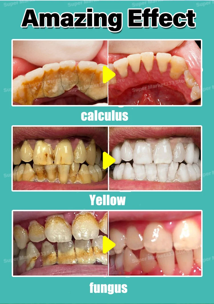 Solve all dental problem tooth decay repair tooth repair fast teeth whitening clean teeth teeth repair cavities