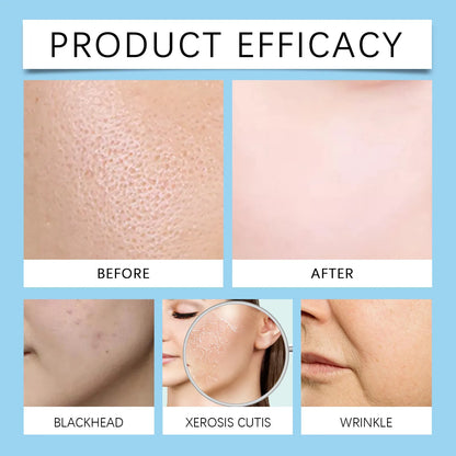 Micro System For Face Micro Infusion System For Lips Micro Infusion System Smooth Nourishes The Skin Facial Oil All Skin Types