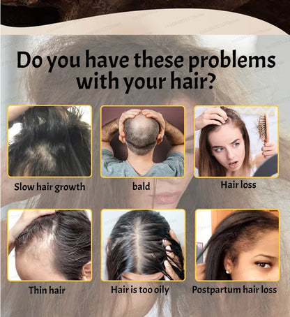 2025 Hair growth oil, repair baldness, hairline, rapid hair growth hair growth oil for men