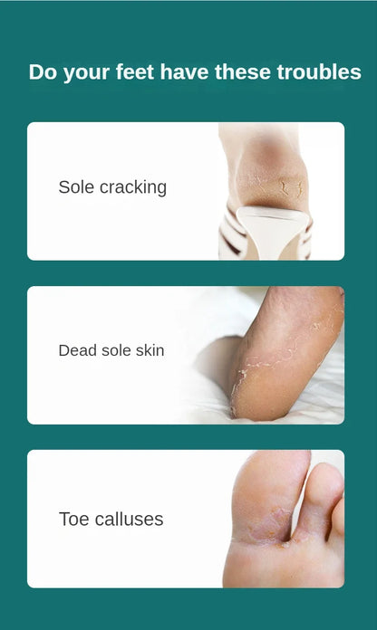 Manicure Pedicure Tools Toe Nail Shaver Feet Pedicure Knife Kit Foot Callus Rasp File Dead Skin Remover Foot Care Tools