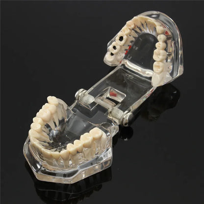 Dental Models Repairable Resin Models Of Diseased Teeth For Teaching And Research In Medicine And Dental Diseases