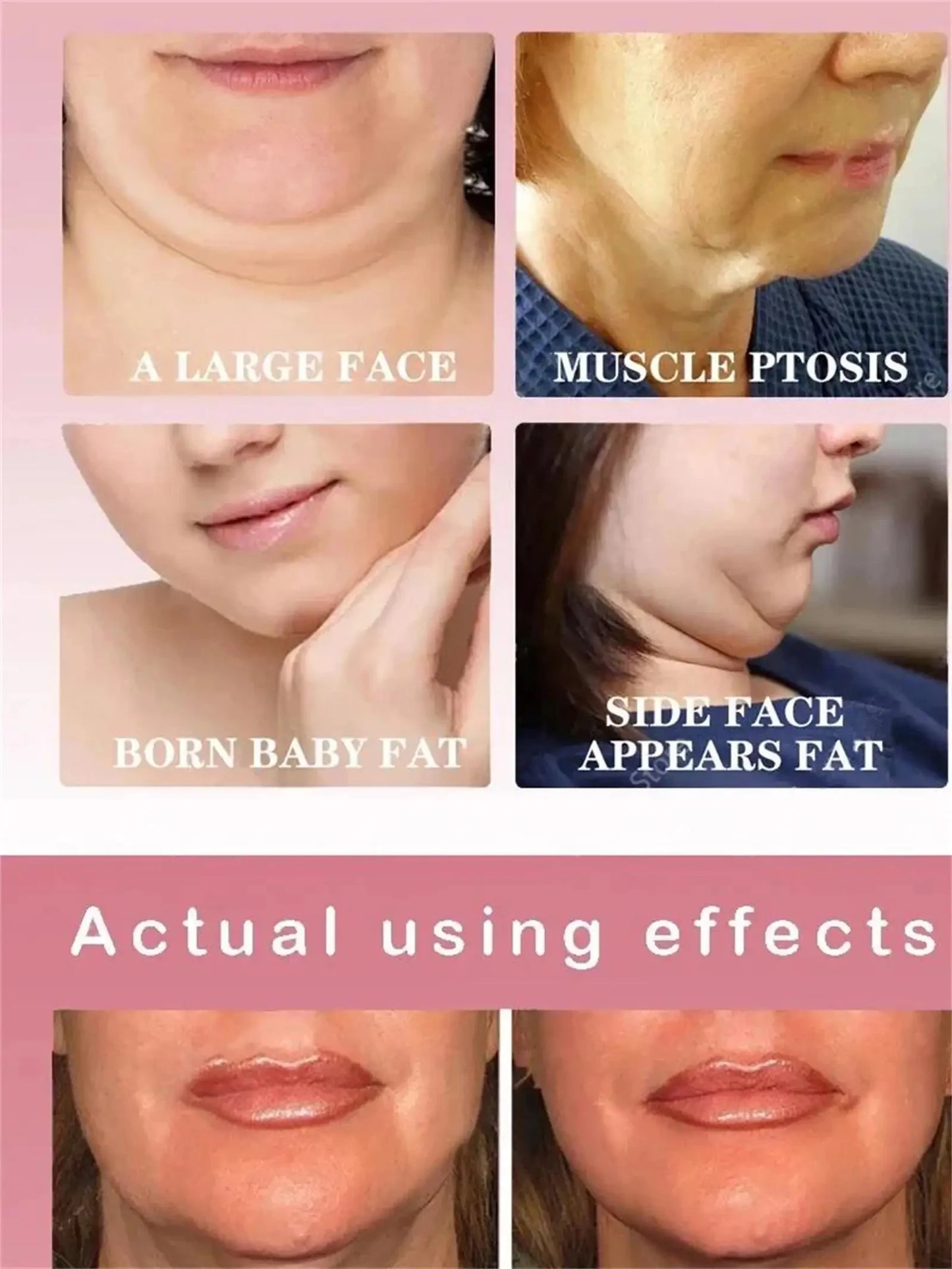 Roller Massager V-Shape Firming Face-lift Slimming Cream Removal Masseter Muscle Double Chin Face Fat Burning Anti-aging Product