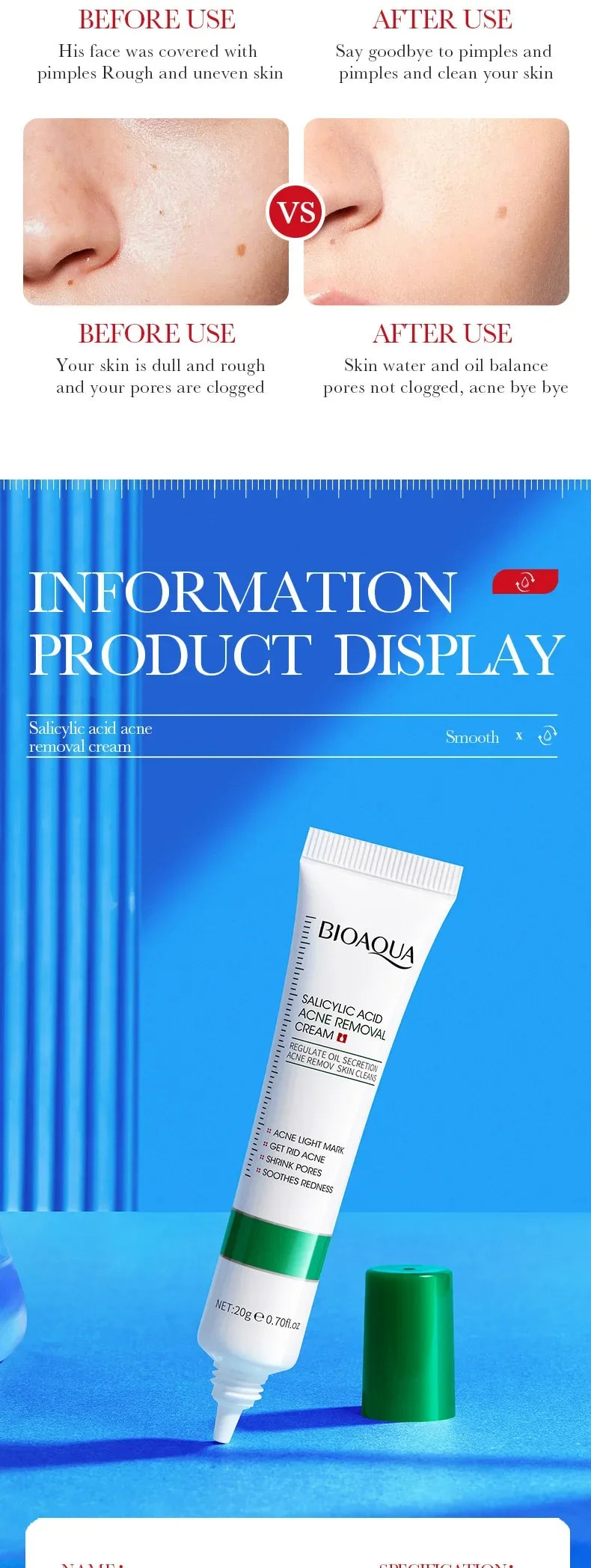 Salicylic Acid Face Cream Acne Creams Mark Repair Firming Moisturizing Blackhead Remover skincare Facial Cream