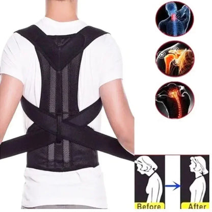 Men's AND WOMEN'S Scoliosis Corrector Kyphosis Corrector Student Adult Posture Corrector Anti-kyphosis Fixed Strap