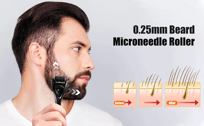 Micro Needling 540 Roller Derma Roller Dermaroller 0.2/0.25/0.3mm Titanium Hair Regrowth Beard Growth Anti-Hair Loss Treatment